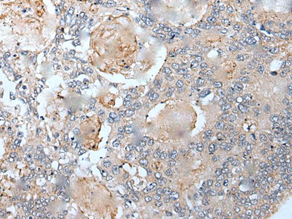 VEZT Antibody