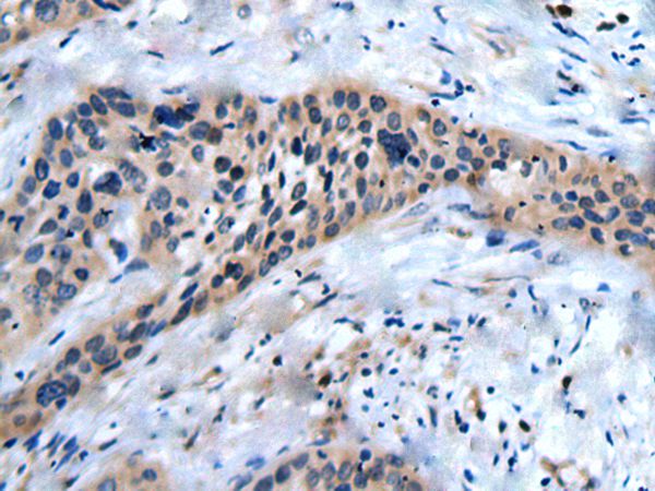 SLC17A8 Antibody