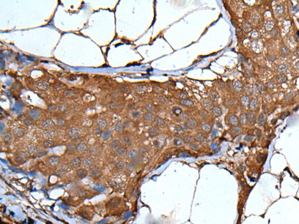 VSIG1 Antibody