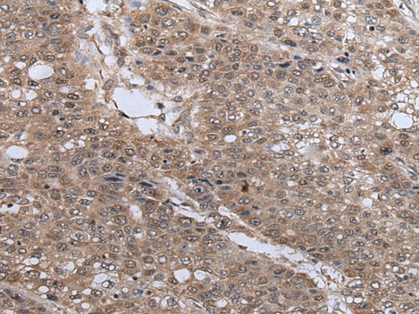 UBE4B Antibody