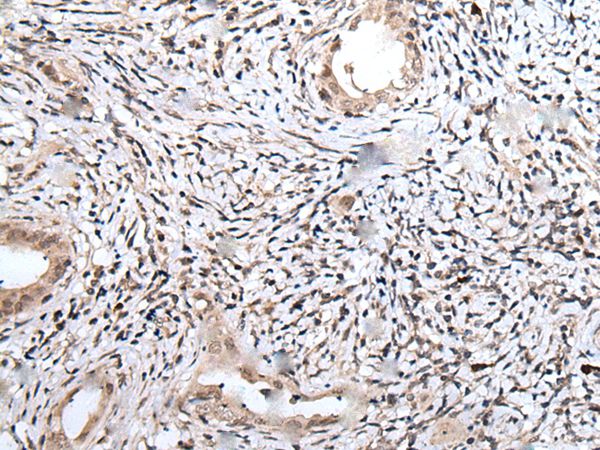 UBN1 Antibody