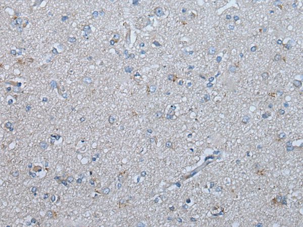 UBR4 Antibody