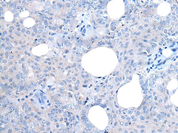 UCK2 Antibody