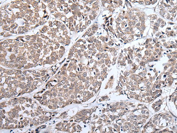 ERBB4 Antibody