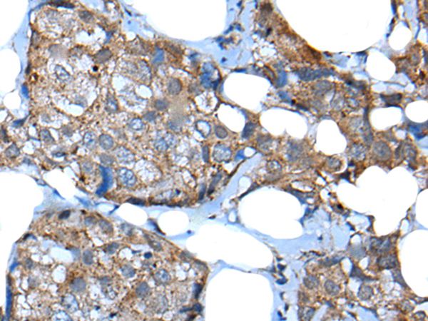 UGT2B15 Antibody