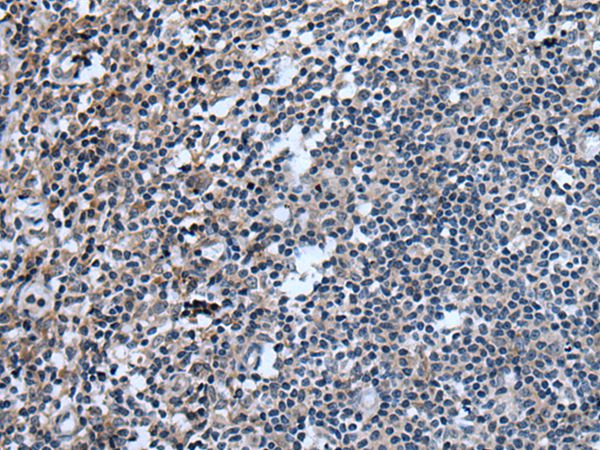 UGT8 Antibody