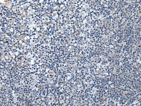 SPTB Antibody