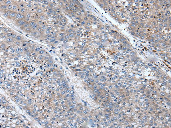 BICD1 Antibody