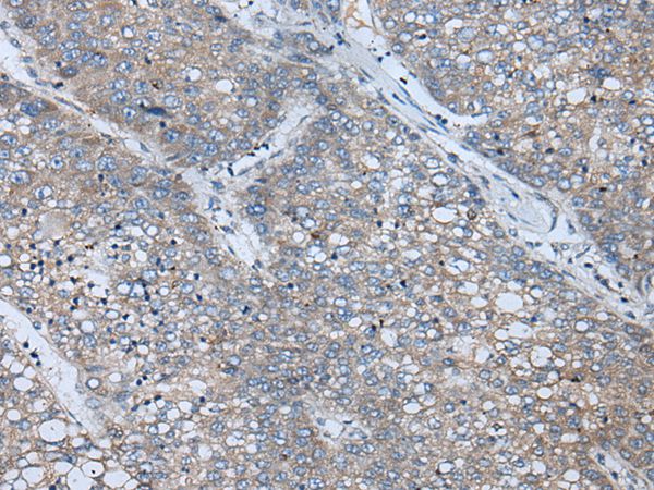 BICD2 Antibody