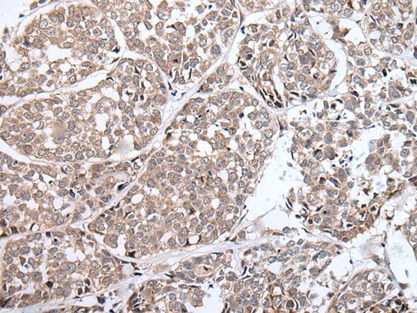 BLM Antibody