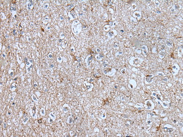 BMP1 Antibody