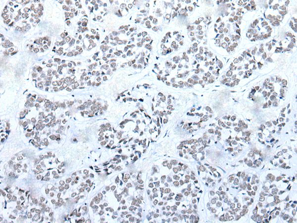 BRD3 Antibody
