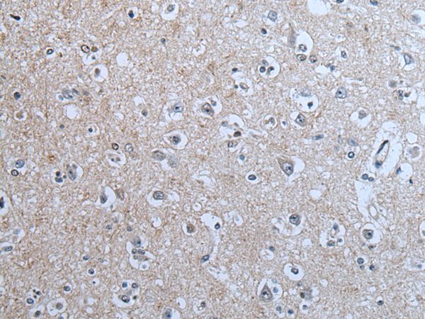 BRSK2 Antibody