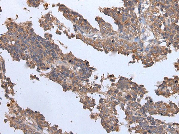 ENPP2 Antibody