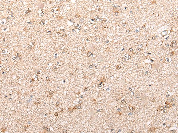 CYP11B2 Antibody