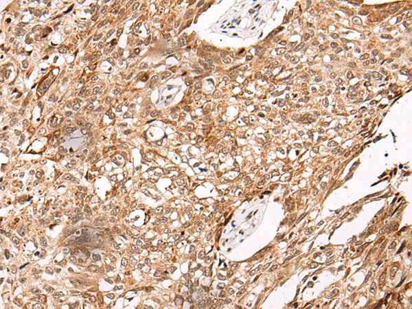 C14orf169 Antibody