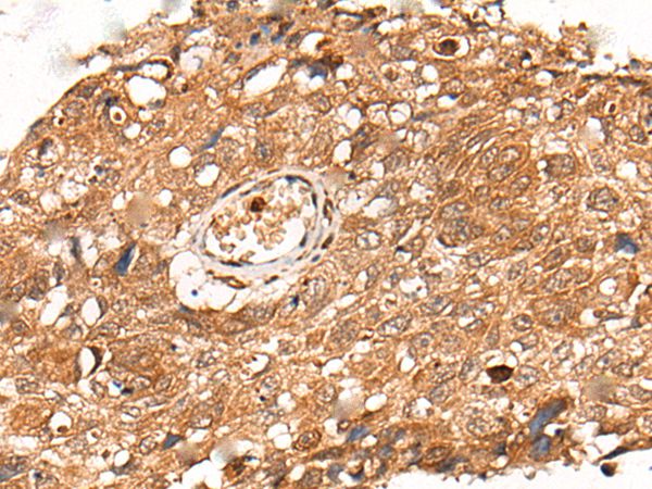 KLHL36 Antibody