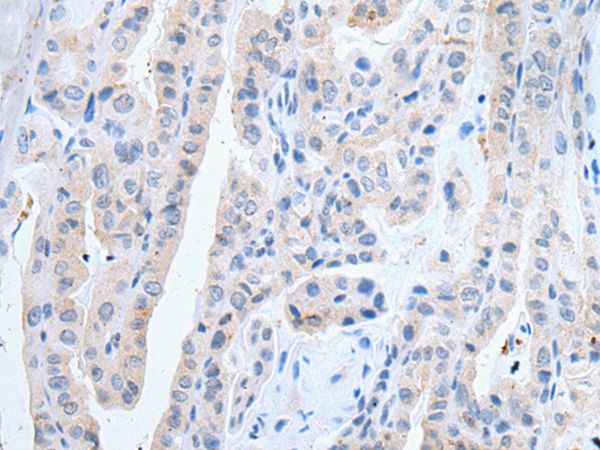 SLCO2B1 Antibody