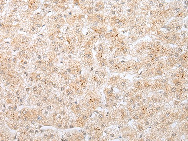 KRTAP11 Antibody