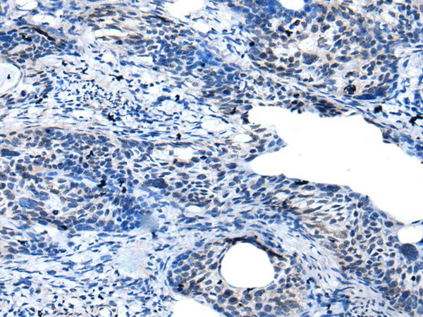GAS2L3 Antibody