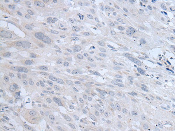TYRP1 Antibody