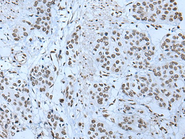 ZBTB4 Antibody