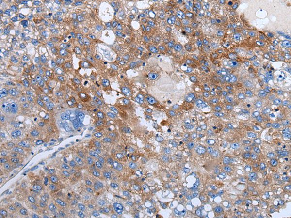 WEE2 Antibody