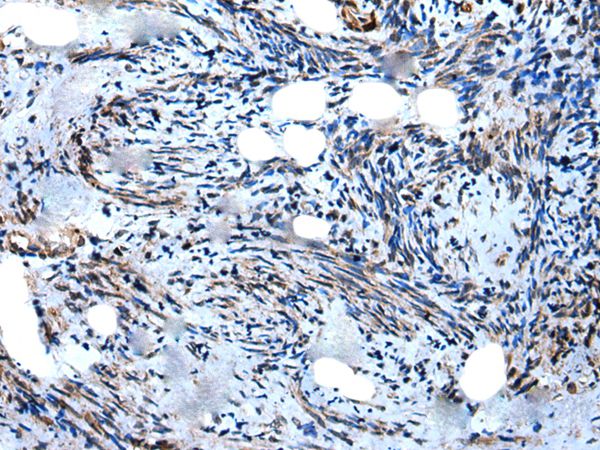 WIPF1 Antibody