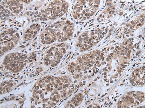 IWS1 Antibody