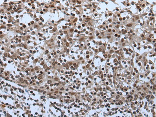 CELF5 Antibody