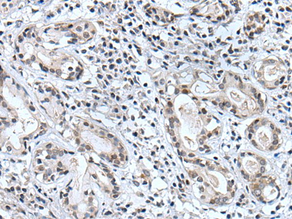 BSPRY Antibody