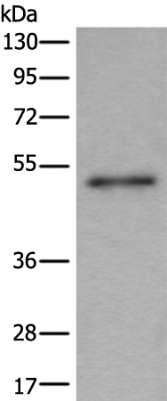 BMP5 Antibody