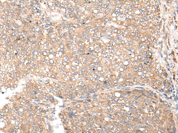 CDC123 Antibody