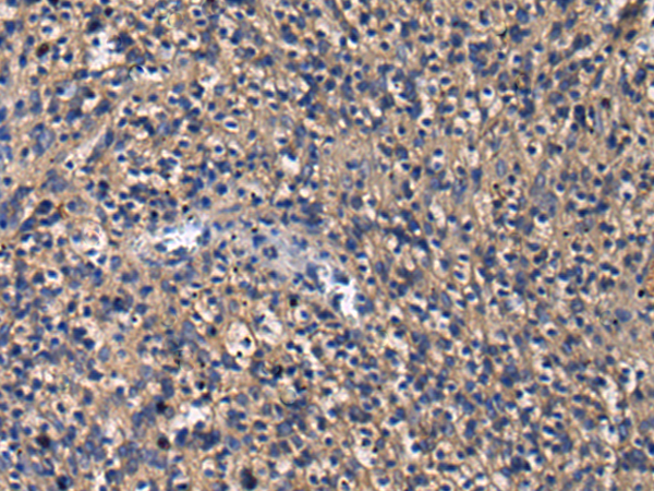 GIGYF1 antibody