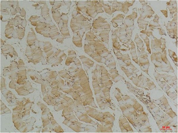 Desmin Monoclonal Antibody(1B12)