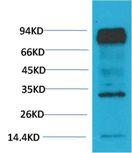 HIF β/ARNT Monoclonal Antibody(4C5)