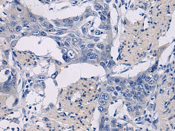 GPR18 antibody
