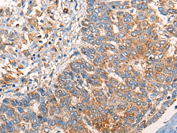ABCC6 Antibody