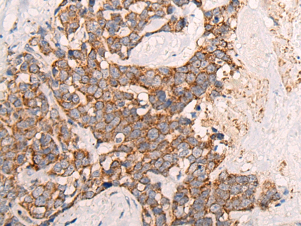 ALDH7A1 Antibody