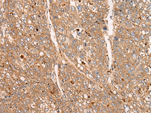 APOBEC1 Antibody