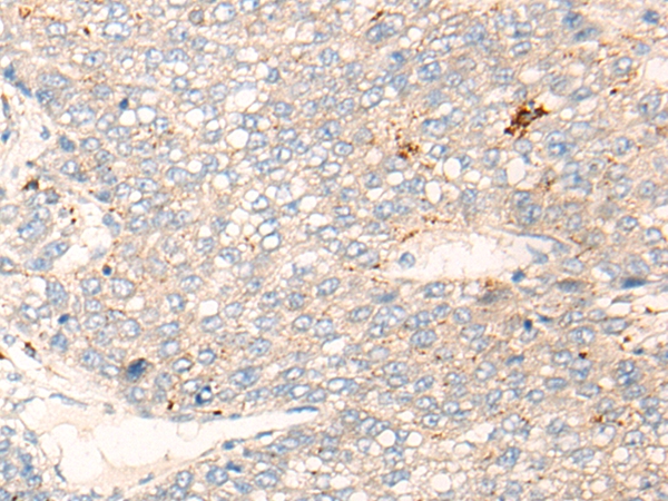 APOBR Antibody
