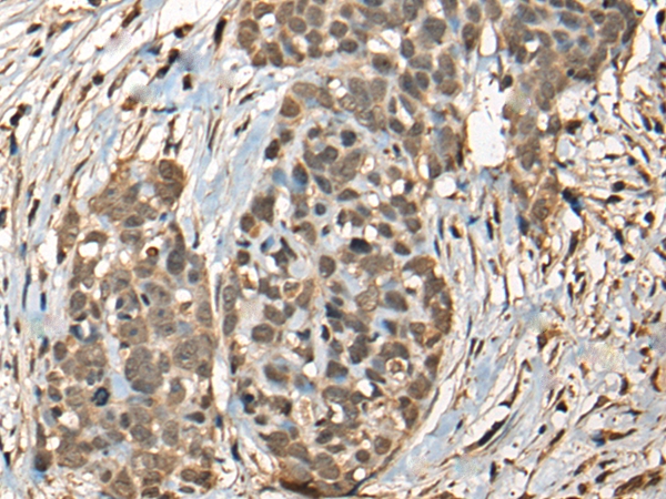 ARID1B Antibody