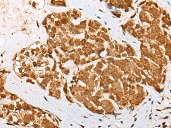 ATN1 Antibody