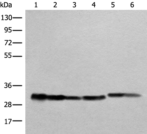 ATP5C1 Antibody
