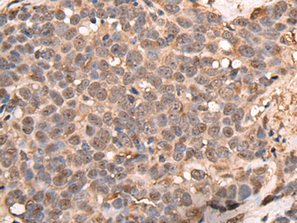 ATRIP Antibody