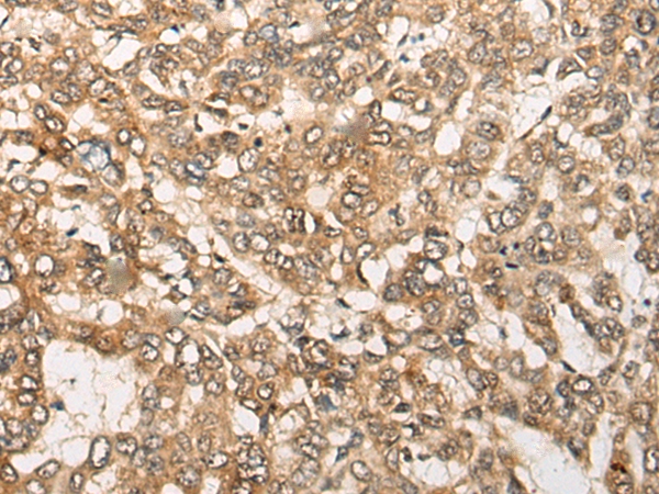 B3GALT6 Antibody