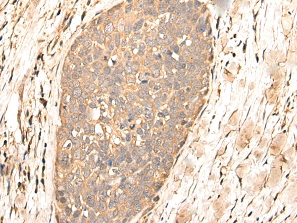 BAALC Antibody