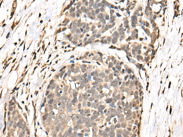 BATF Antibody