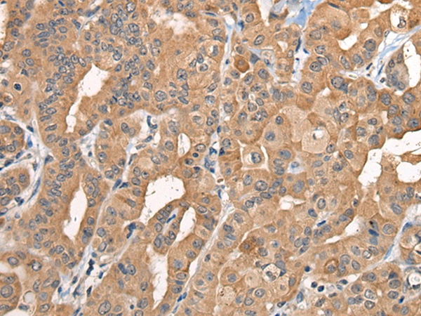BCAN Antibody