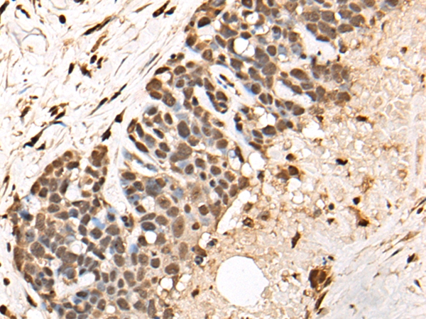 BCL9 Antibody